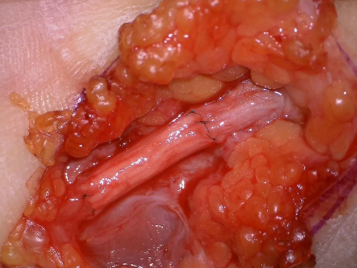 Biologische Überbrückungs- und Transplantationskonzepte